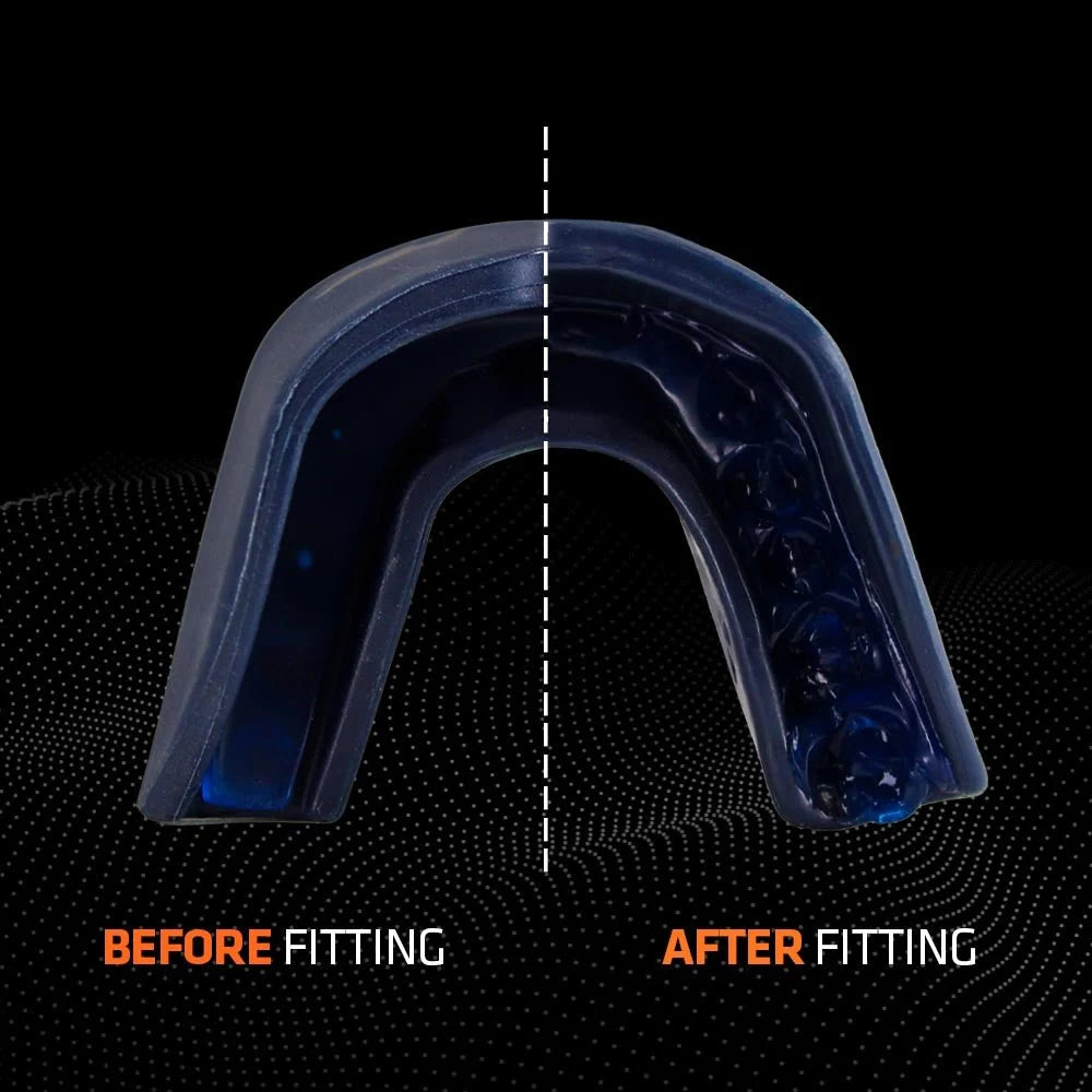 Shock Doctor Gel Strike Mouthguard